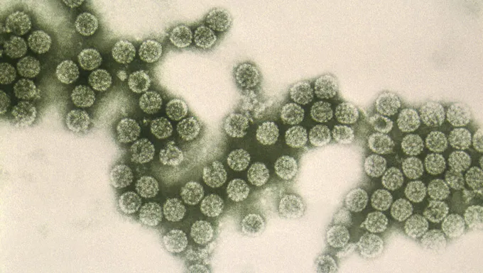 He made beer that’s also a vaccine. Now controversy is brewing